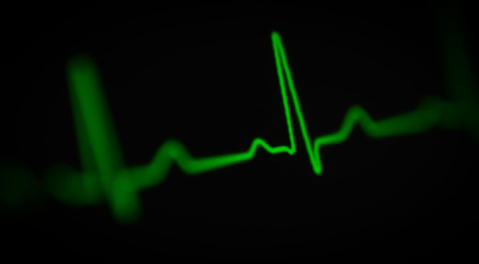How to make HEART metrics work in practice